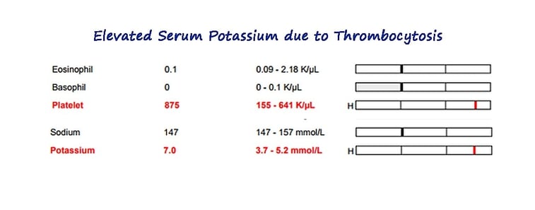 pseudohyperkalemia.jpg